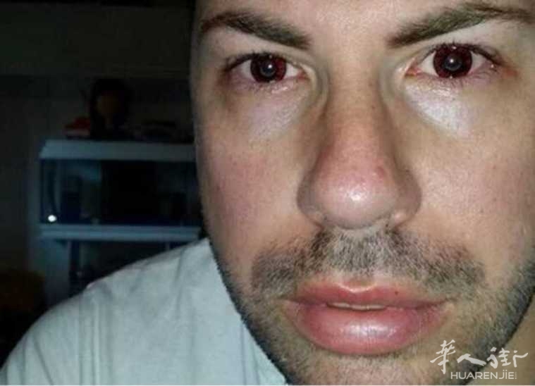 picture.jpg 意大利渣男令40多名女性感染艾滋