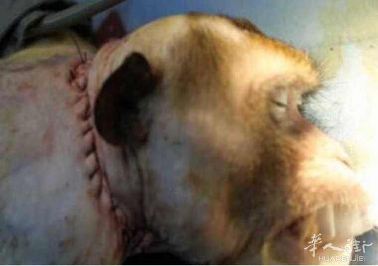 picture.jpg 全球首例"换头术"志愿者决定不换了?