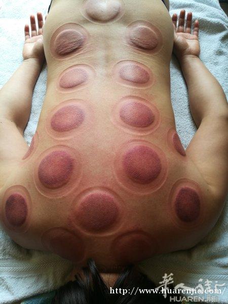 中医推拿按摩师。专治各种疑难杂症。上门服务。