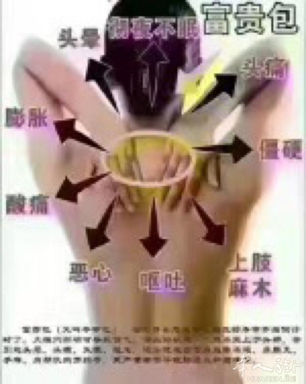 本人从事中医推拿，拔罐治疗颈椎，腰痛，请电话联系。