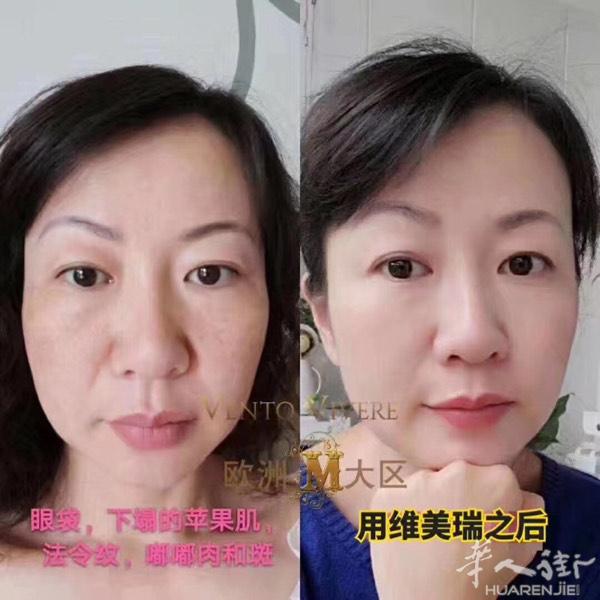 现货出售 防疫安全帽 瑞士水光面膜 法国玻尿酸面膜