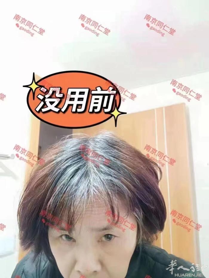 乌发精华