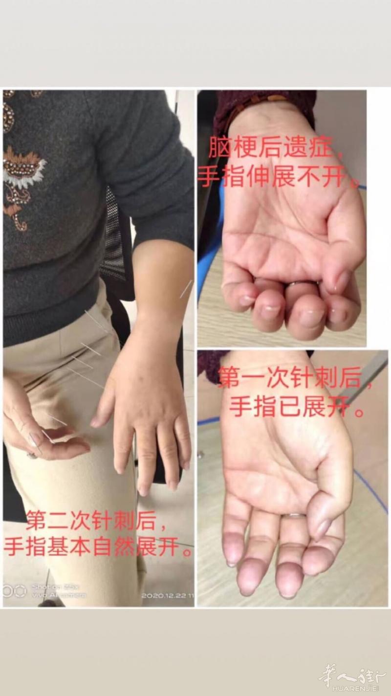 朋友们好！（筋柔骨正气血冲盛关节不疼）身体和关节有